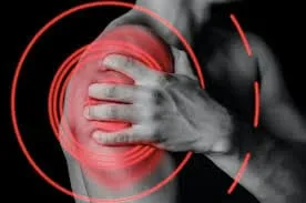 Running Injuries